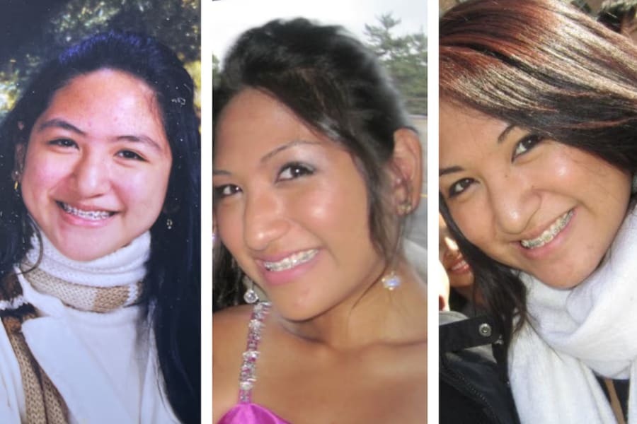 3 Images of a smiling teenager with braces.