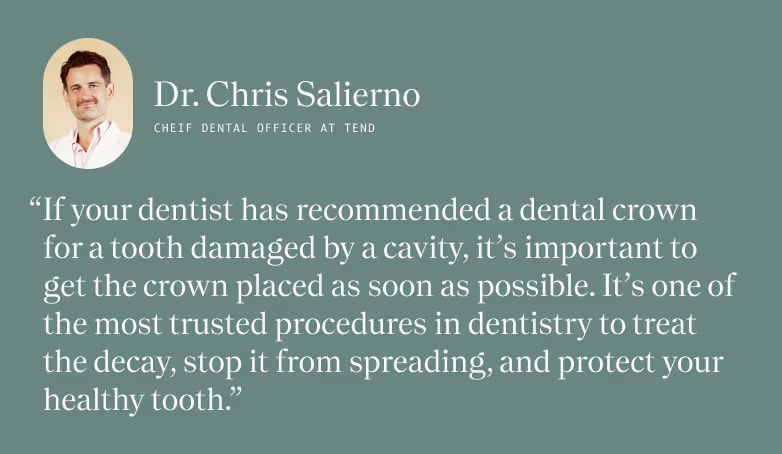 Quote from Dr. Salierno, "If your dentist has recommended a dental crown for a tooth damaged by a cavity, it's important to get the crown place as soon as possible. It's on of the most trusted procedures in dentistry to treat the decay, stop it from spreading and protect your healthy tooth."